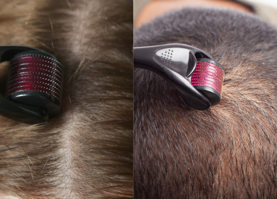 Achieve Stronger, Healthier Hair with Microneedling, Derma Rollers, and Formula No.1 Hair Care Products